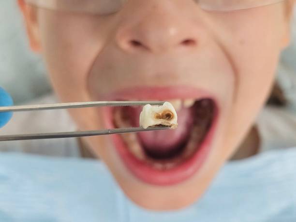 Best Emergency Treatment for Toothache in Gates Mills, OH